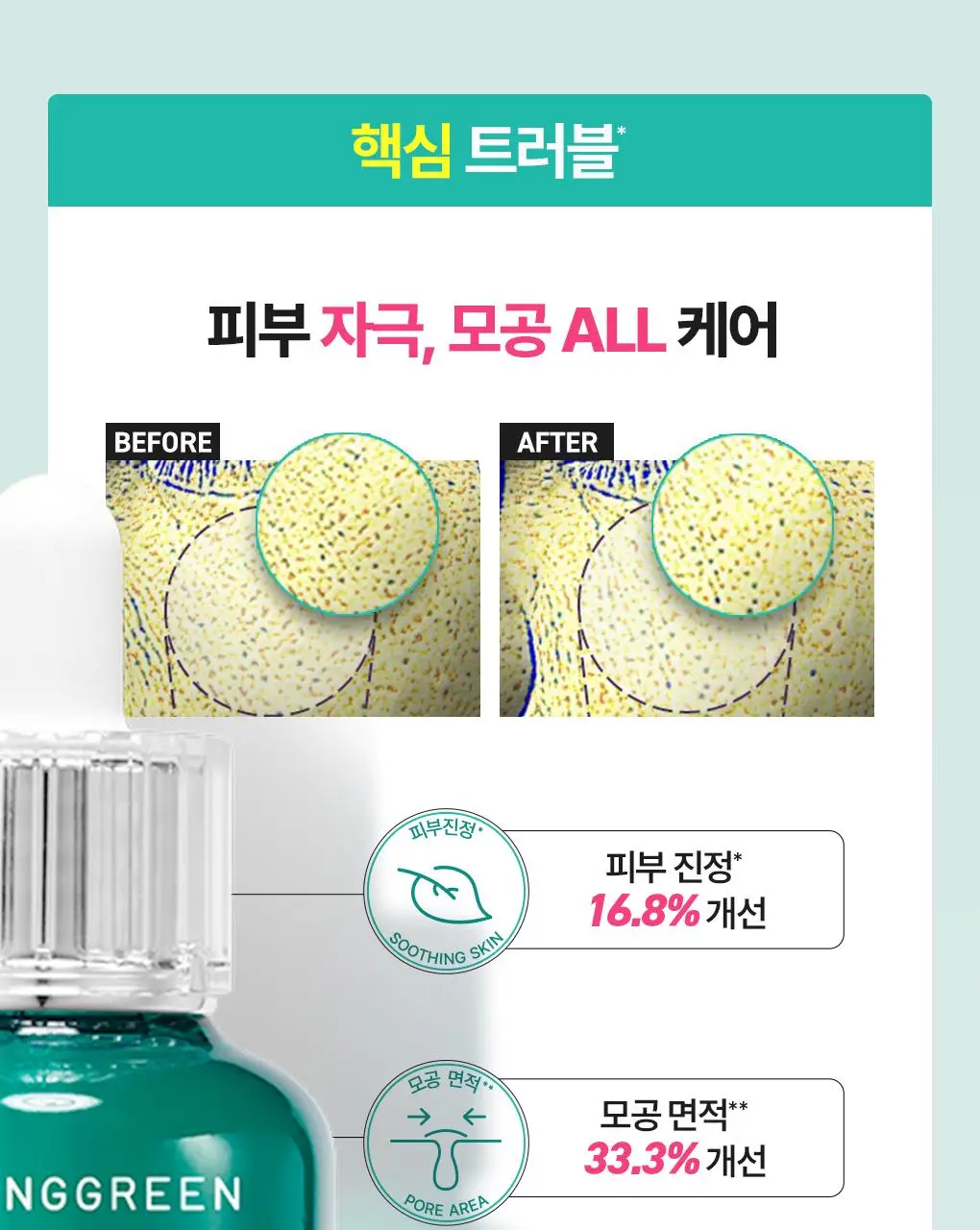 [7월올영픽/3일진정세럼]브링그린 징크테카 트러블 세럼 대용량 기획 상세페이지 31